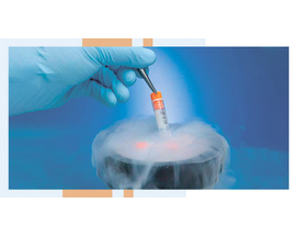 Sperm cryopreservation